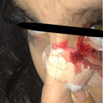 Case Report Image