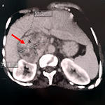 Case Report Image