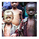 Malnutrition in Sub–Saharan Africa: burden, causes and prospects