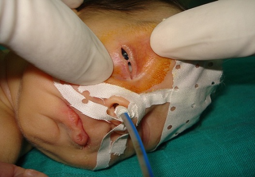 Quiz Image