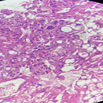 Clinical Image 1