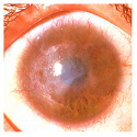 Article Thumbnail Image