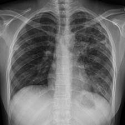 Article Thumbnail Image