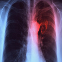 Article Thumbnail Image