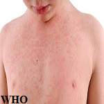 Article Thumbnail Image