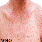 Article Thumbnail Image