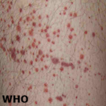 Article Thumbnail Image