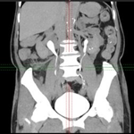 Article Thumbnail Image