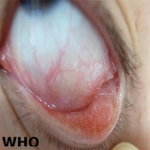 Article Thumbnail Image