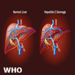 Article Thumbnail Image
