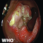 Article Thumbnail Image
